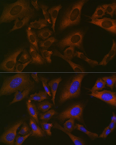 BMP6 Rabbit mAb