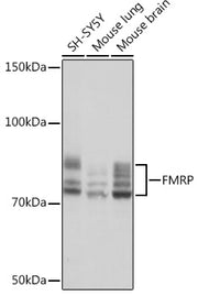 FMRP Rabbit mAb