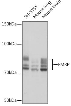 FMRP Rabbit mAb