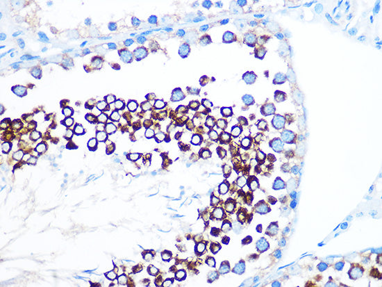 FMRP Rabbit mAb