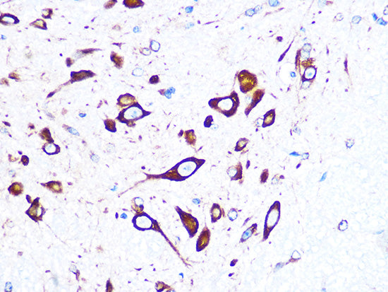 FMRP Rabbit mAb