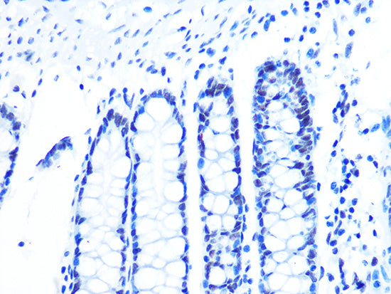 U2AF2/U2AF65 Rabbit mAb