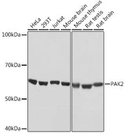 PAK2 Rabbit mAb
