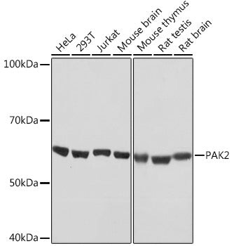 PAK2 Rabbit mAb