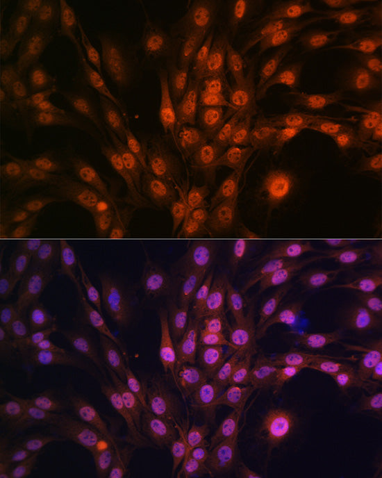 PAK2 Rabbit mAb