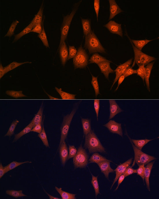 PAK2 Rabbit mAb
