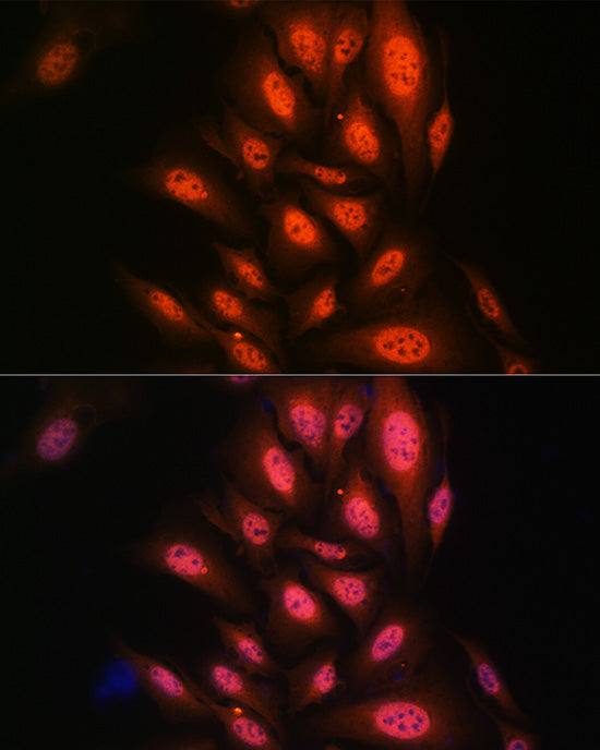 PAK2 Rabbit mAb