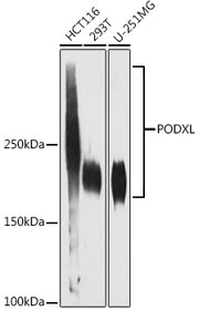 PODXL Rabbit mAb