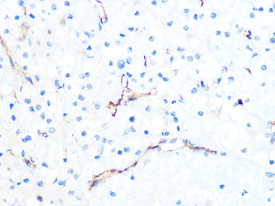 PODXL Rabbit mAb