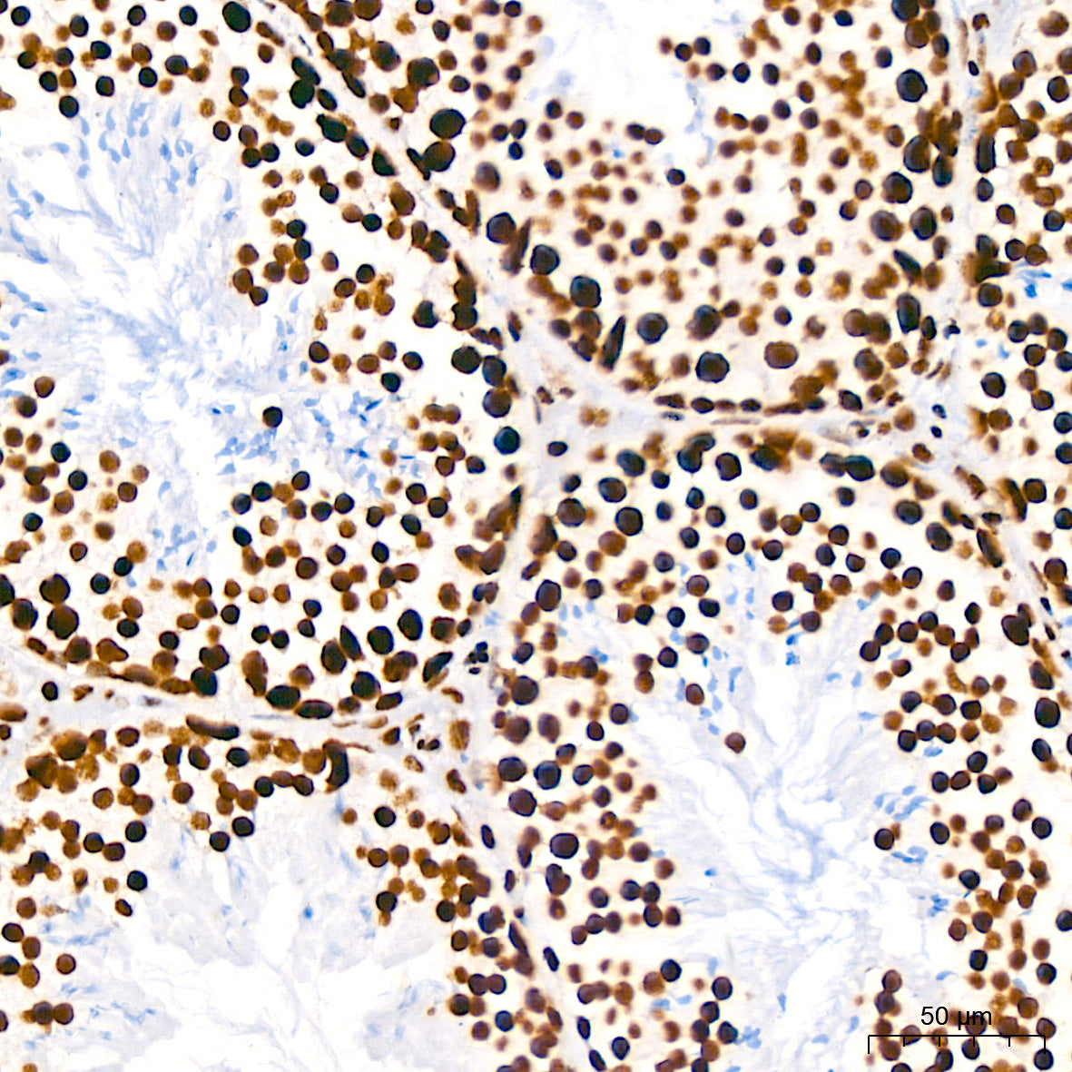 DHX9/RNA Helicase A Rabbit mAb