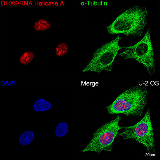DHX9/RNA Helicase A Rabbit mAb