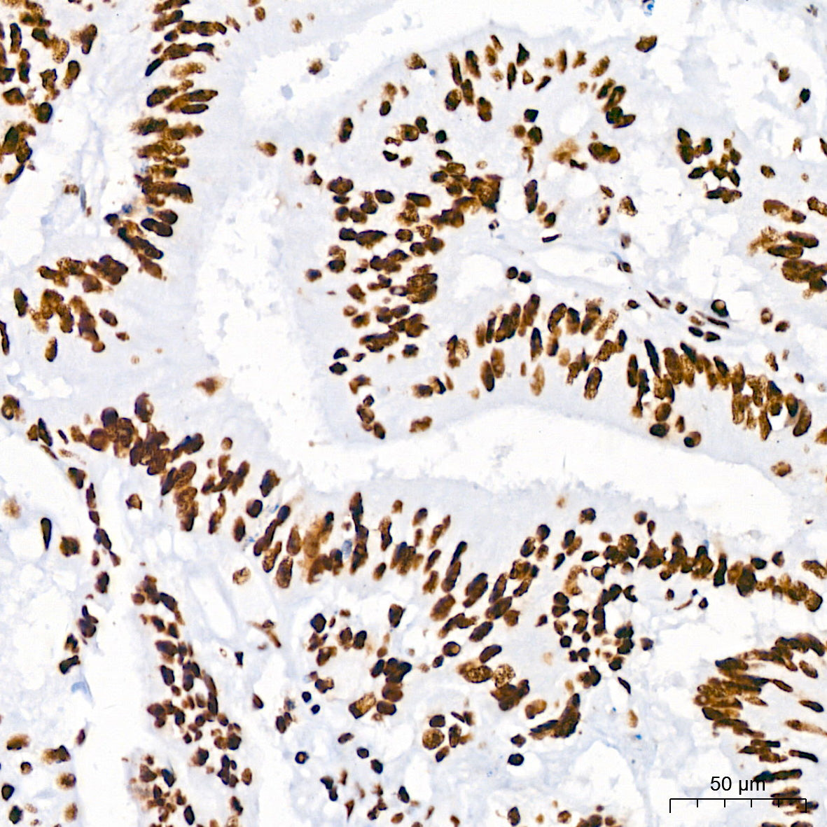 DHX9/RNA Helicase A Rabbit mAb