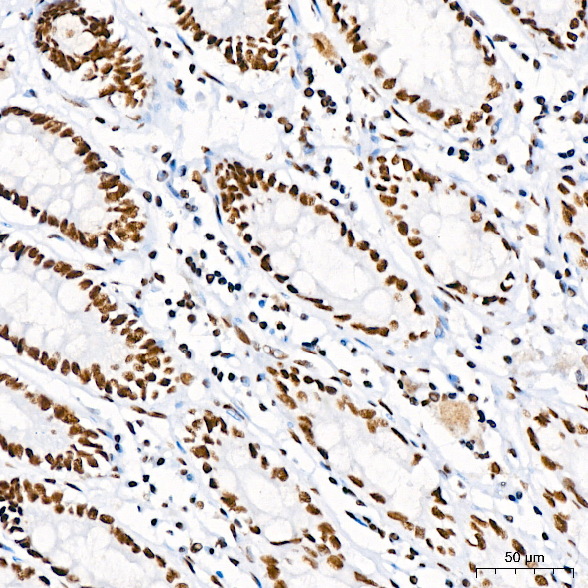 DHX9/RNA Helicase A Rabbit mAb