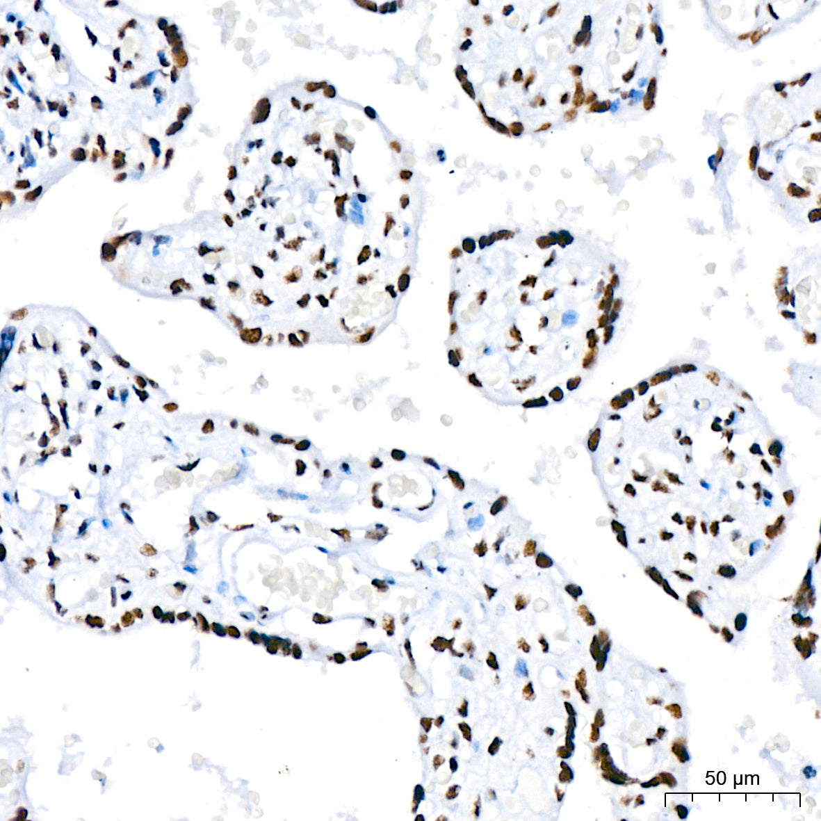 DHX9/RNA Helicase A Rabbit mAb