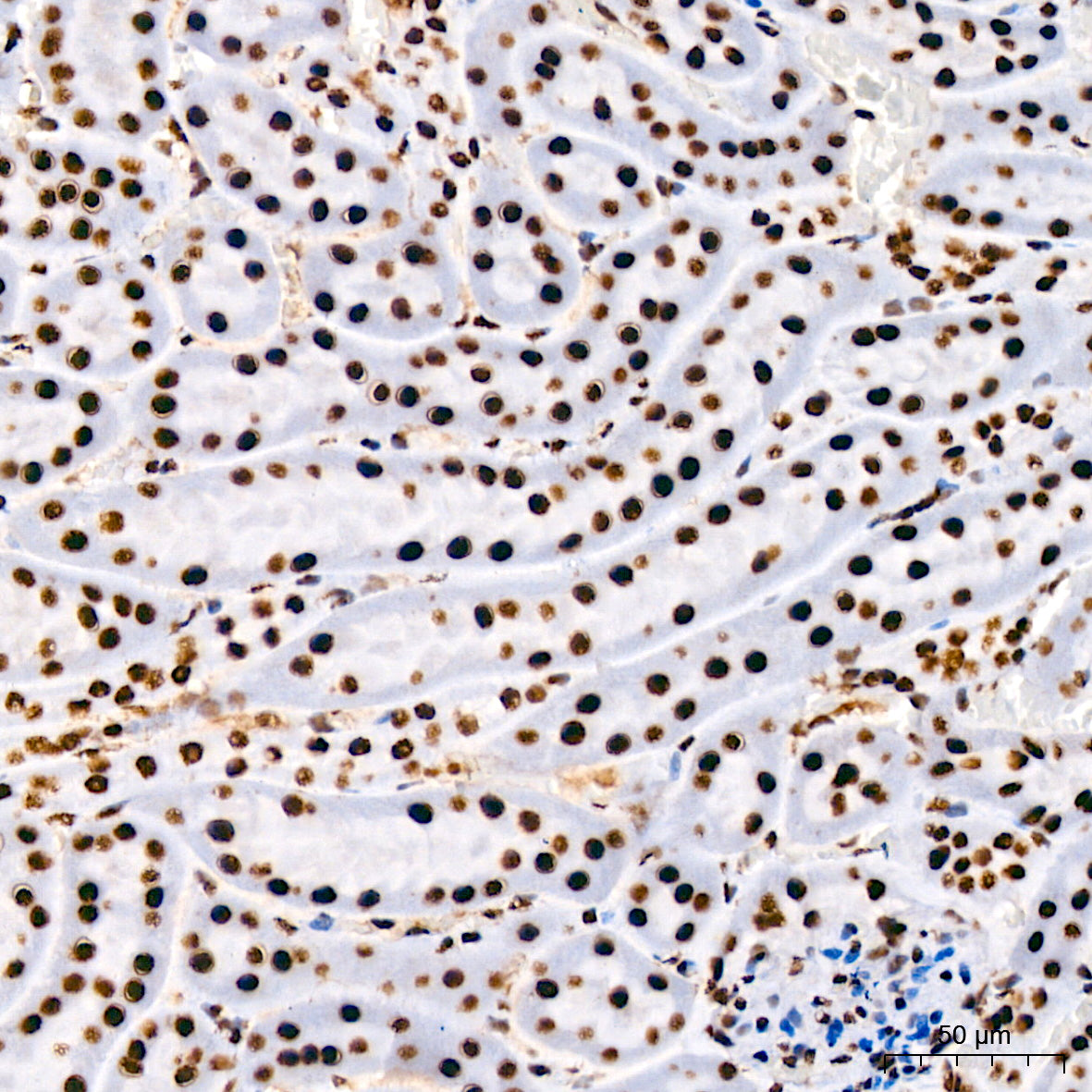 DHX9/RNA Helicase A Rabbit mAb