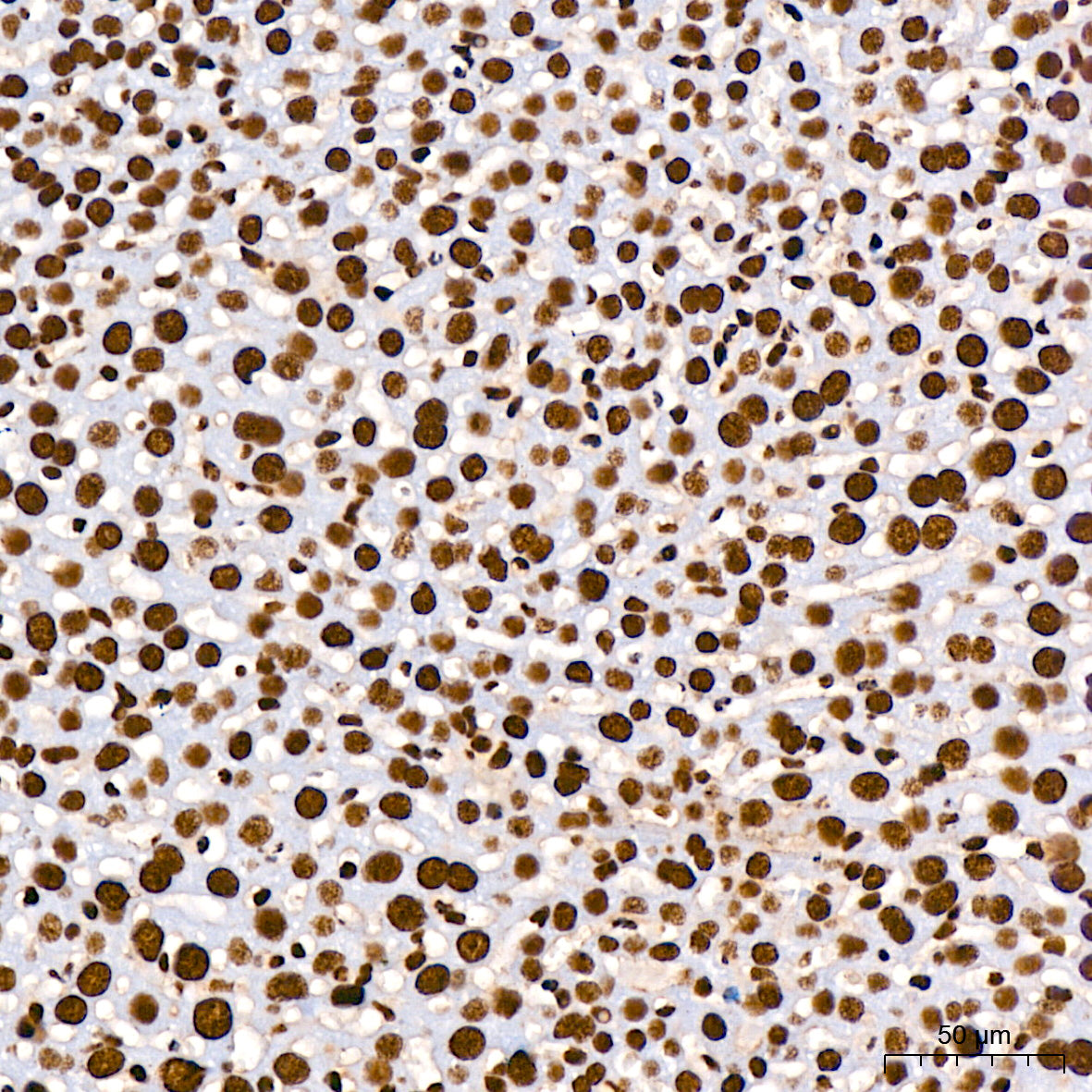 DHX9/RNA Helicase A Rabbit mAb