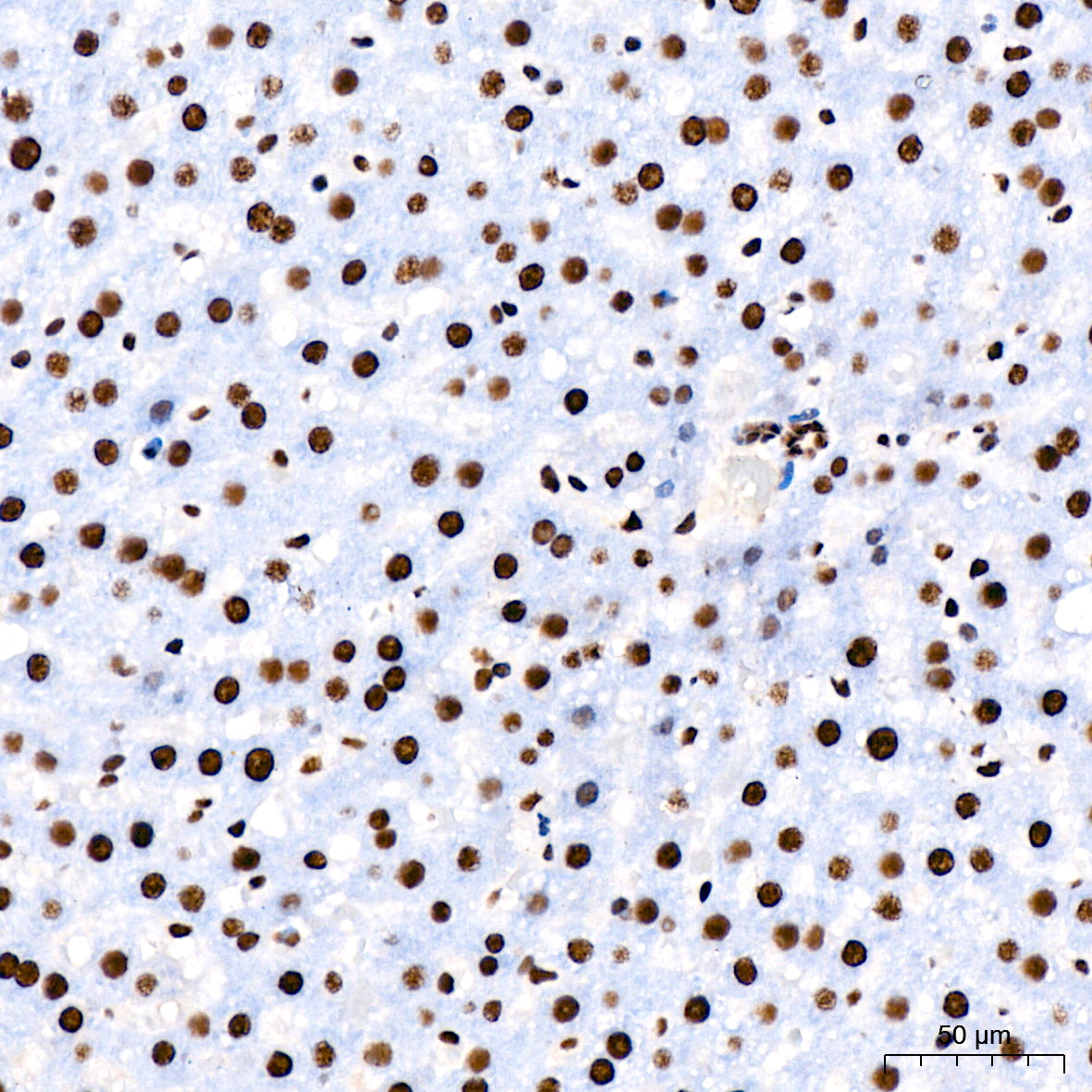 DHX9/RNA Helicase A Rabbit mAb