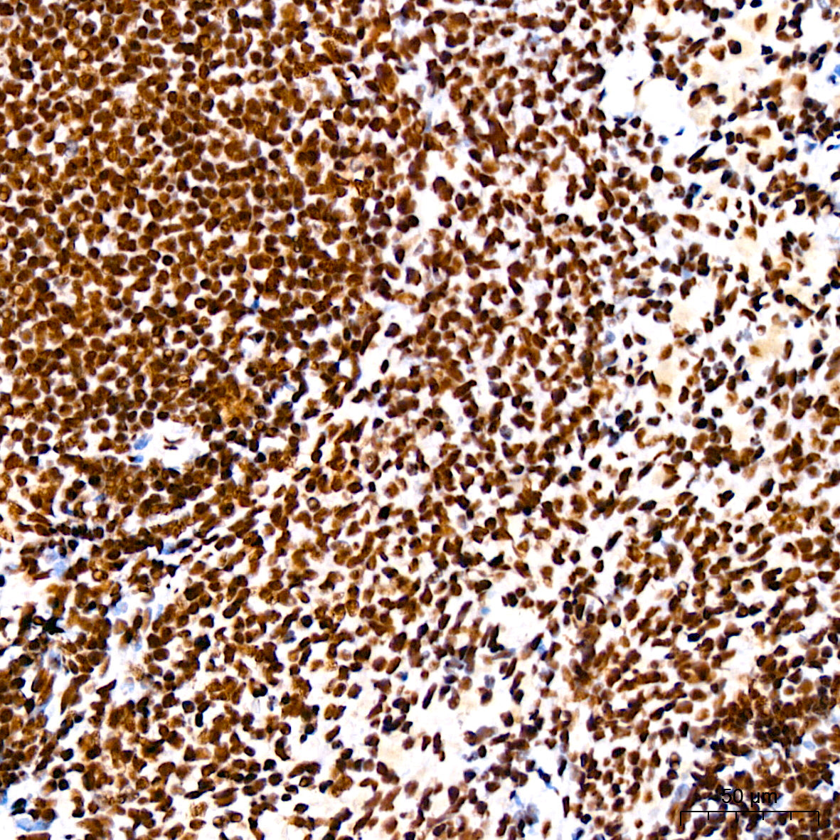 DHX9/RNA Helicase A Rabbit mAb