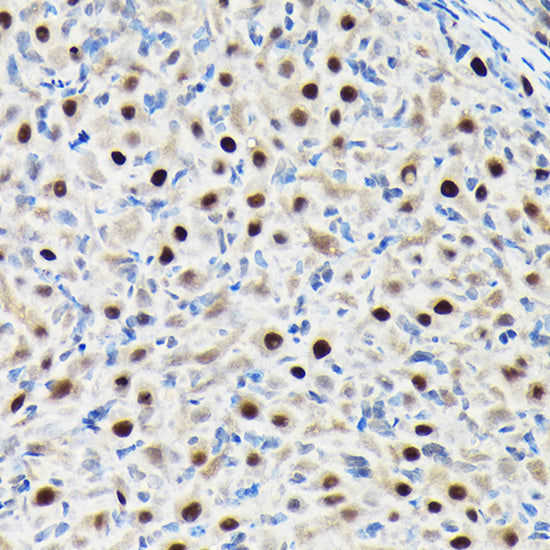 GTPBP4 Rabbit pAb