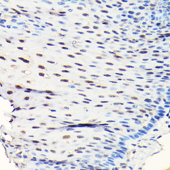 GTPBP4 Rabbit pAb