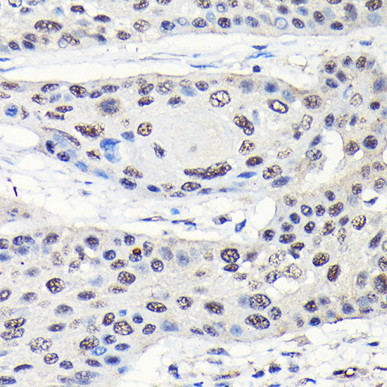 GTPBP4 Rabbit pAb
