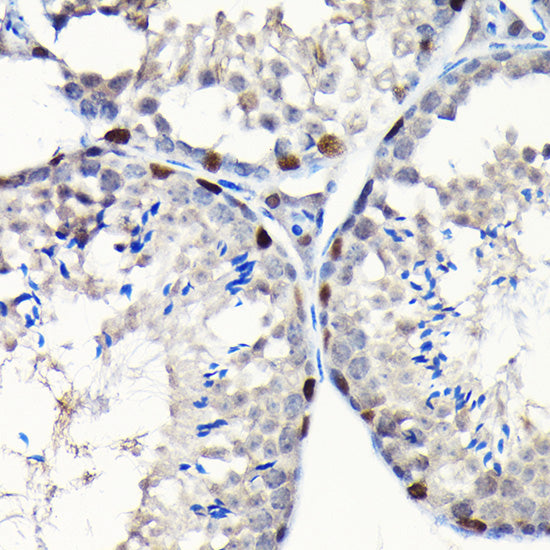 GTPBP4 Rabbit pAb