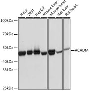 ACADM Rabbit mAb