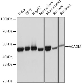 ACADM Rabbit mAb