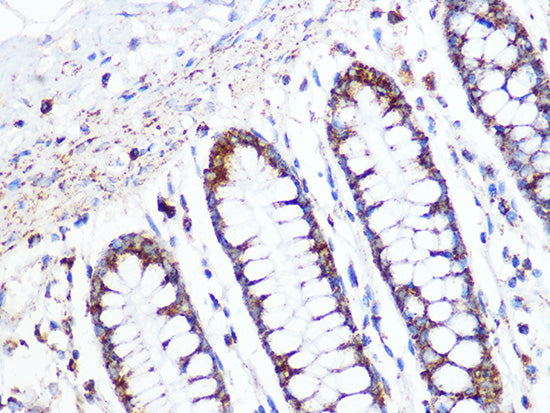 ACADM Rabbit mAb