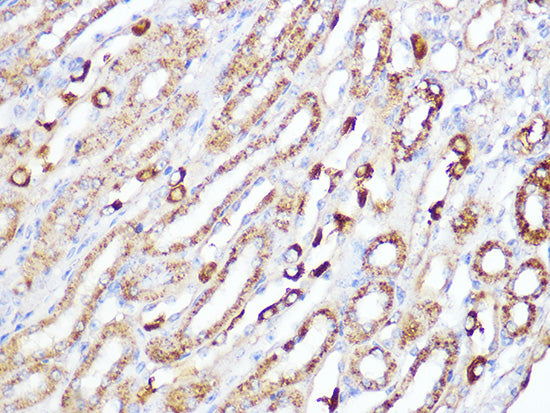 ACADM Rabbit mAb