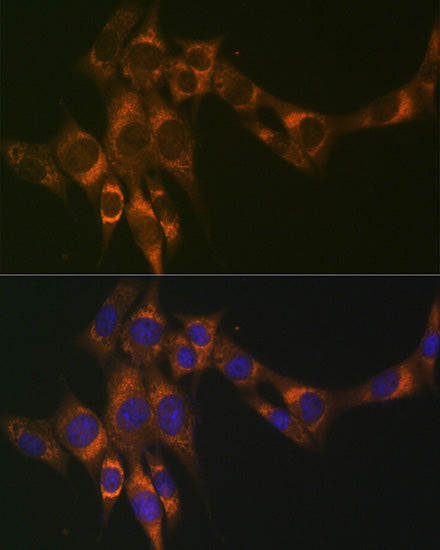 ACADM Rabbit mAb