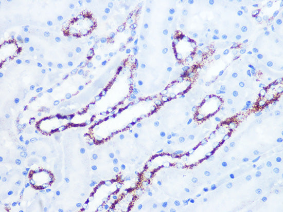 Citrate synthetase Rabbit mAb