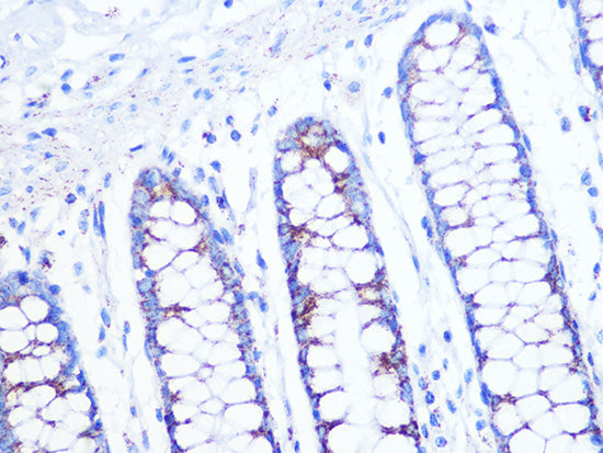 Citrate synthetase Rabbit mAb