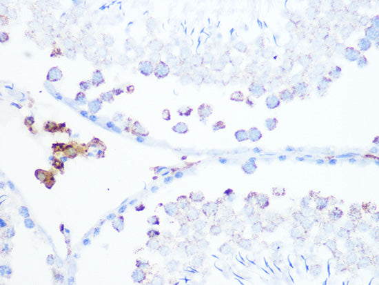 Citrate synthetase Rabbit mAb