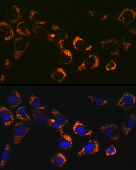 Citrate synthetase Rabbit mAb