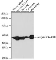 Integrin linked ILK Rabbit mAb