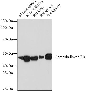 Integrin linked ILK Rabbit mAb