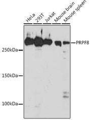 PRPF8 Rabbit mAb
