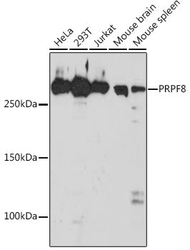 PRPF8 Rabbit mAb