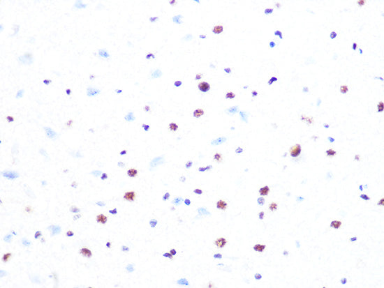 PRPF8 Rabbit mAb