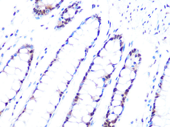 PRPF8 Rabbit mAb