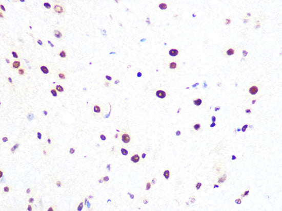 PRPF8 Rabbit mAb