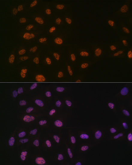 PRPF8 Rabbit mAb