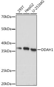DDAH1 Rabbit mAb