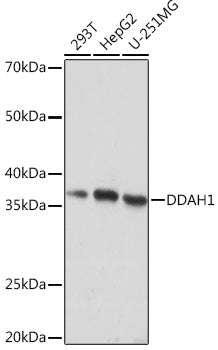 DDAH1 Rabbit mAb