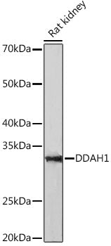 DDAH1 Rabbit mAb