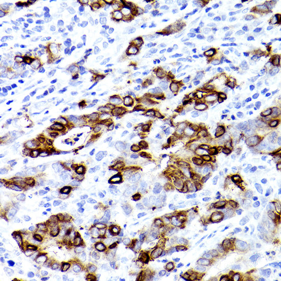 TFF3 Rabbit mAb