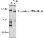 Integrin beta 4 (ITGB4/CD104) Rabbit mAb