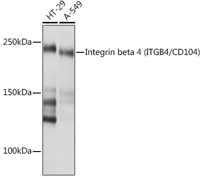 Integrin beta 4 (ITGB4/CD104) Rabbit mAb