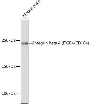 Integrin beta 4 (ITGB4/CD104) Rabbit mAb